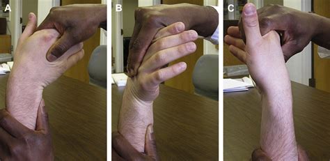 ulnar carpal abutment test